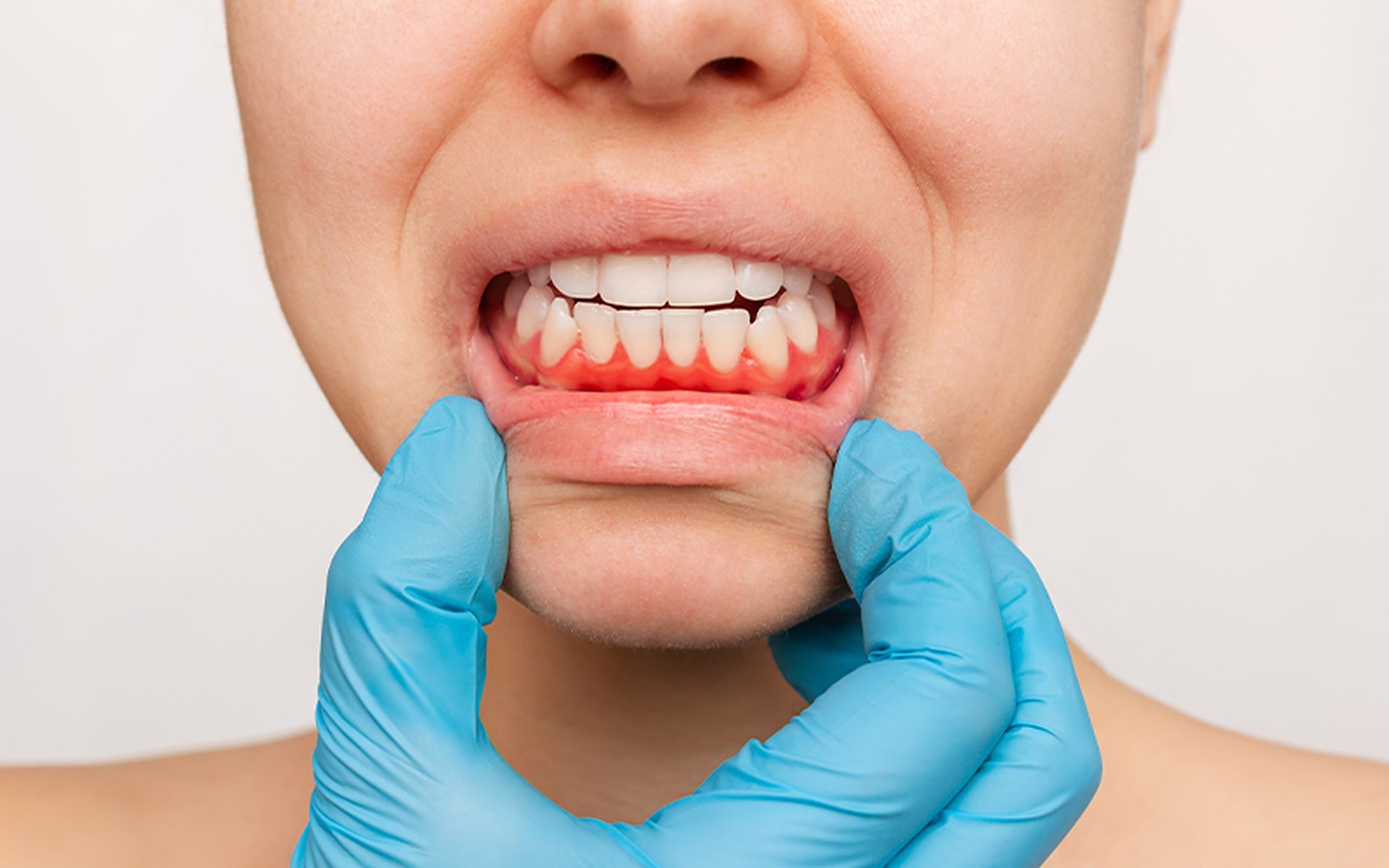 Periodontia